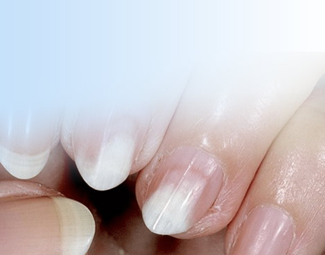 Лікування деформаціі нігтьової пластини: